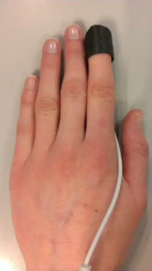 Illustration for Finger