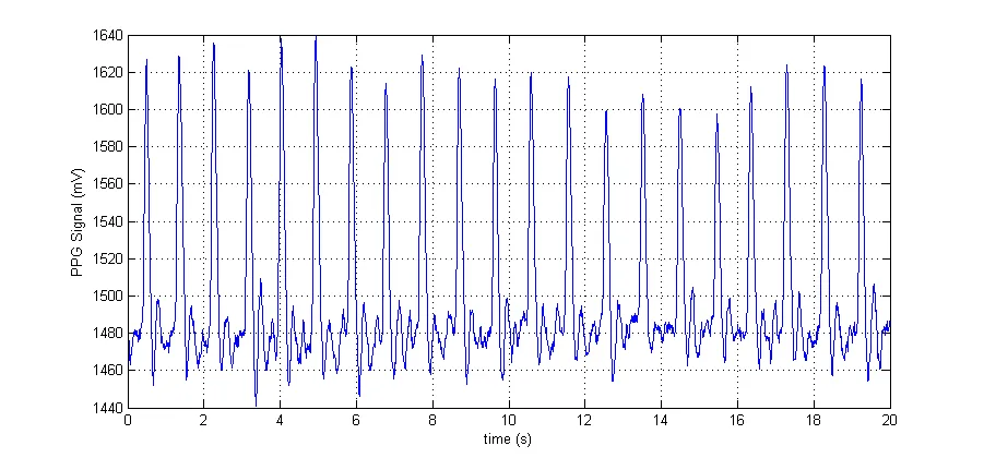 Figure 5‑1 Example PPG Signal measured from Shimmer Optical Pulse Sensor